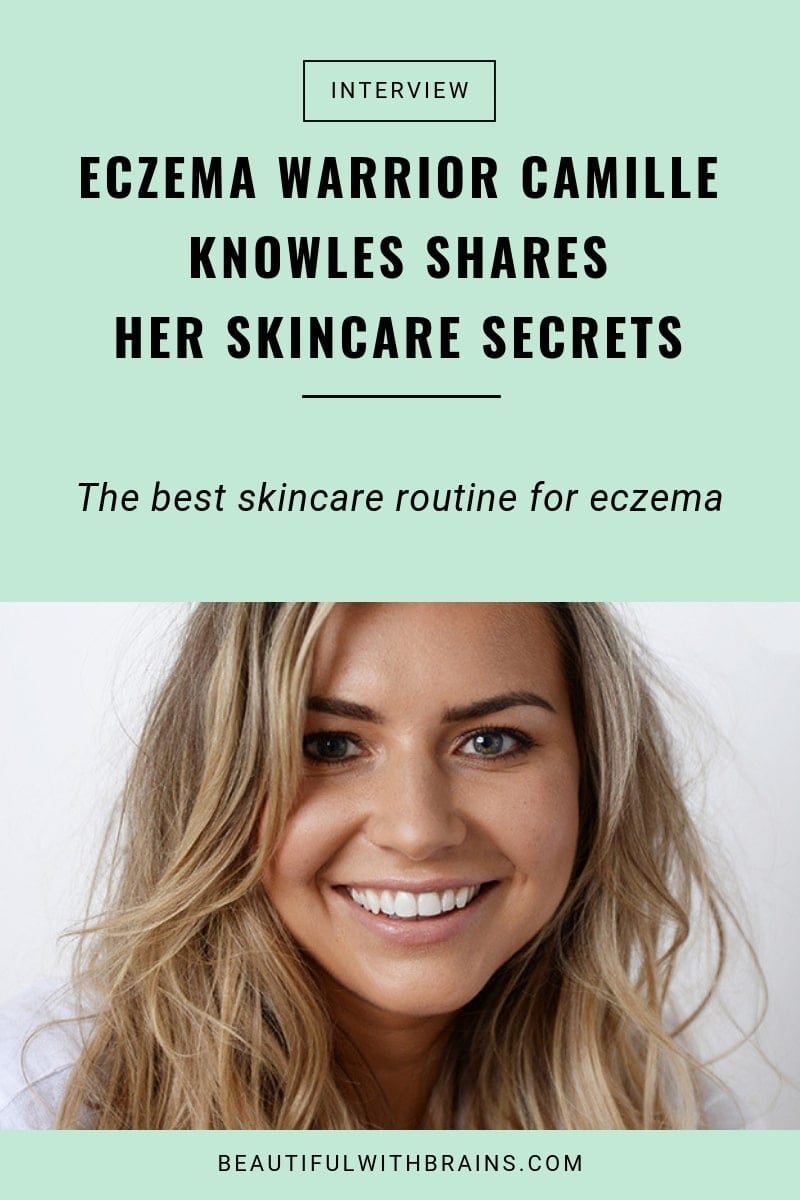 camille knowles eczema interview