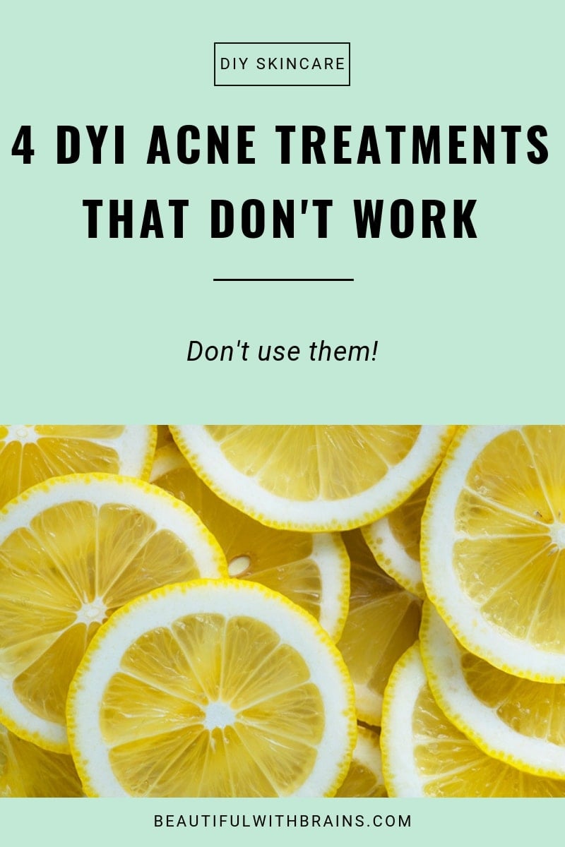 diy anti-acne treatments that don't work