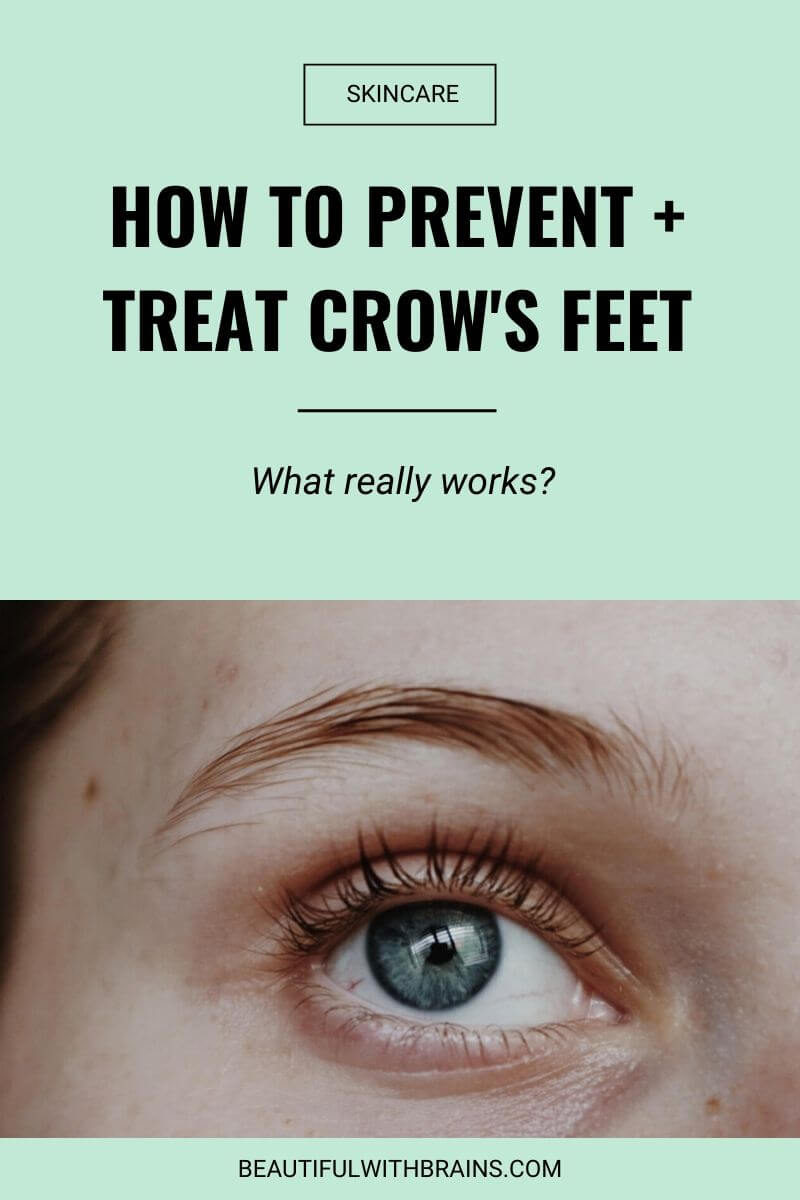 how to treat and prevent crow's feet