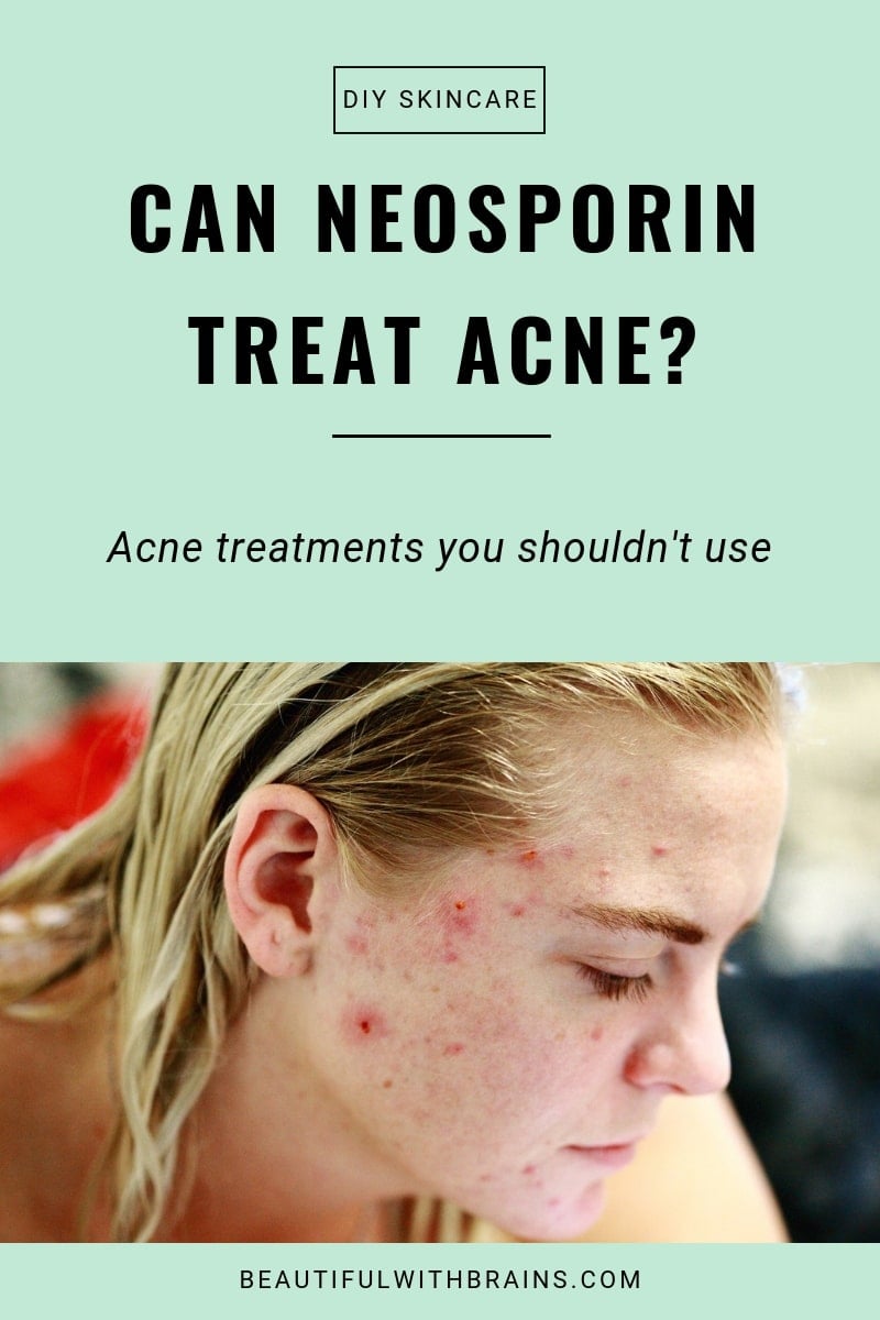 neosporin treats acne