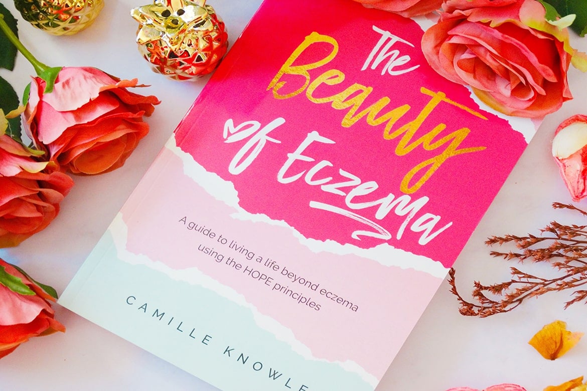 the beauty of eczema by camille knowles 01